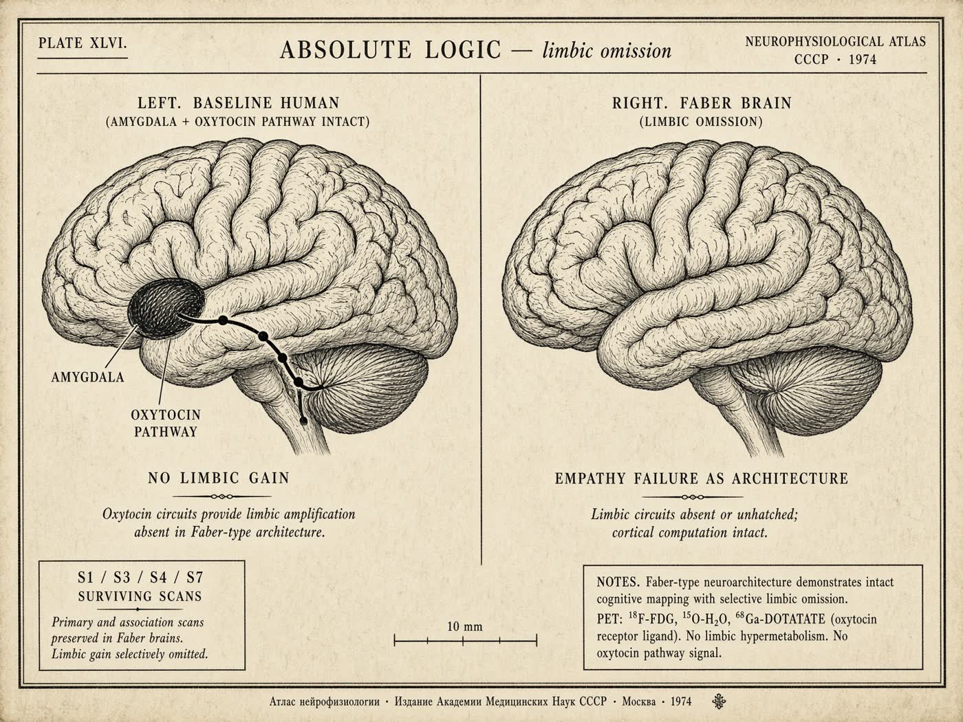 Atlas plate: Absolute Logic. Limbic omission.