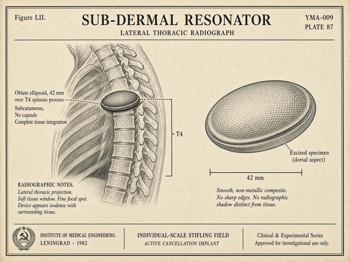 Atlas plate: Sub-dermal resonator. T4 subcutis.