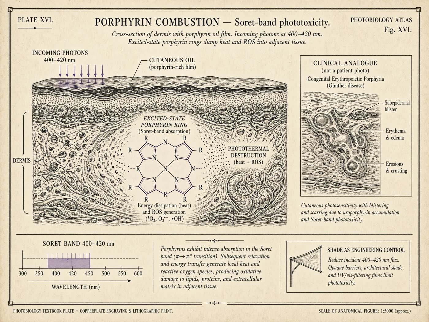 Atlas plate: Porphyrin combustion. Dermal porphyrin film.